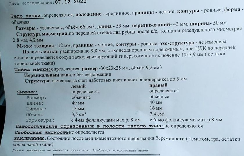Узи