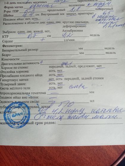 Узи