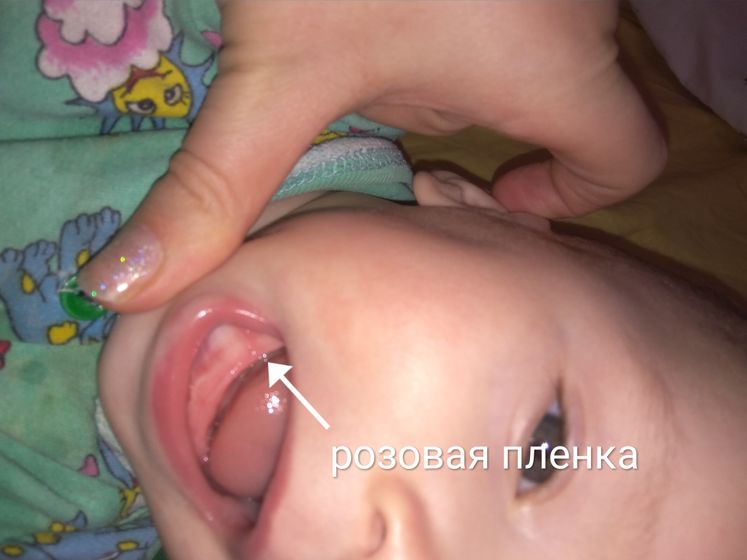 Розовая пленка