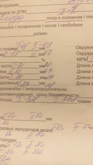 Вес у двойни