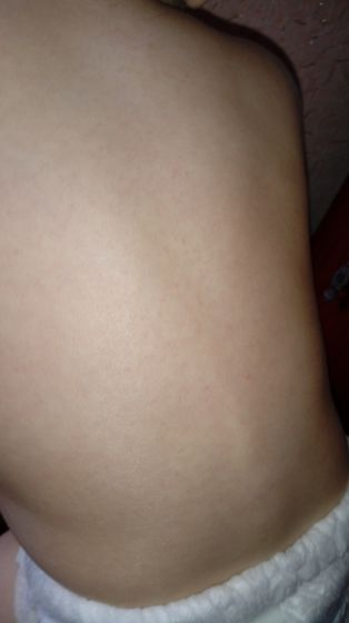 Скажите девочки.аллергия?