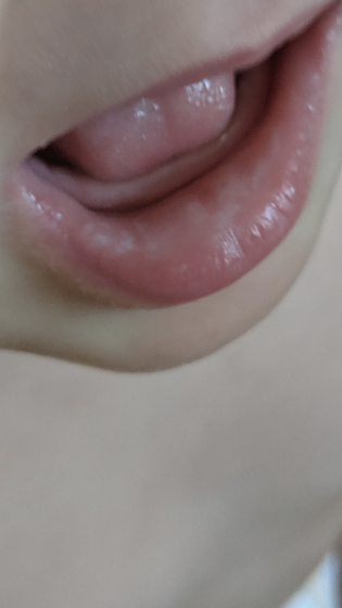 Не молочница же??