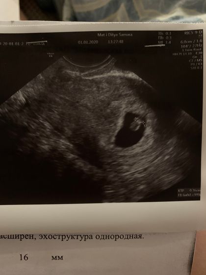 23 дпп тонус