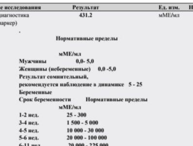 Хгч 431,2 ? 15
