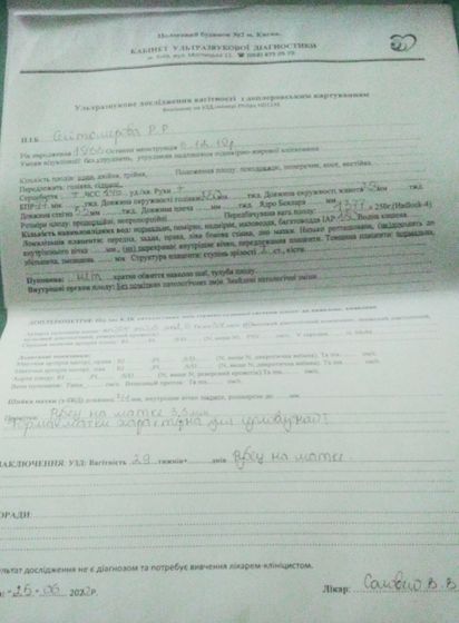 Узи 29 недель)))