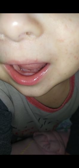 Девочки десна белые, никак