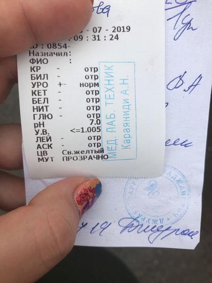 Белок в моче то есть,то его нет?!как так??