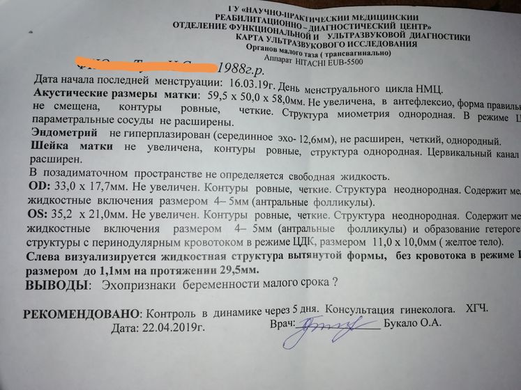 Фото УЗИ и я опять ничего не понимаю
