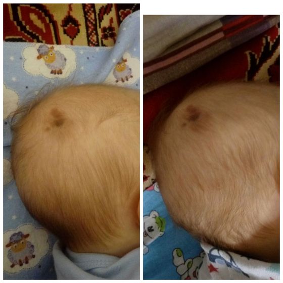 Это пятно меня настораживает((