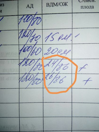 Посмотрите цифры похоже ли,что