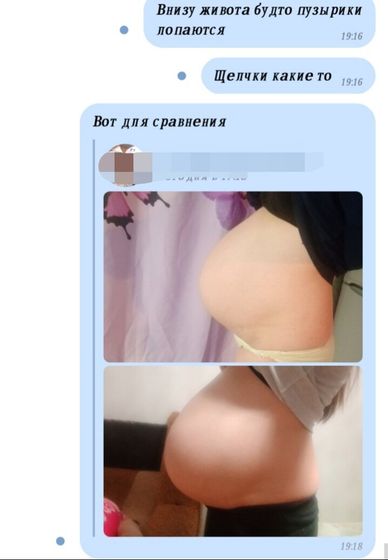 Живот периодически каменеет,немного, приложение