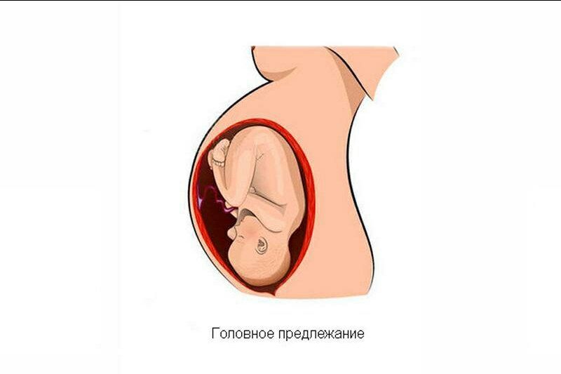 На какой неделе ребенок лёг вниз головой?