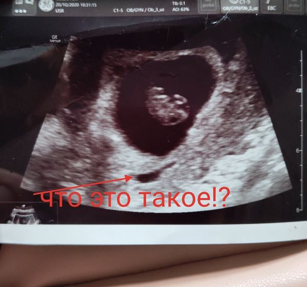 Что это такое?есть тут кто то кто шарит в узи?