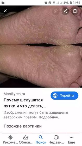 Девочки как избавиться от таких стоп проблемы такой