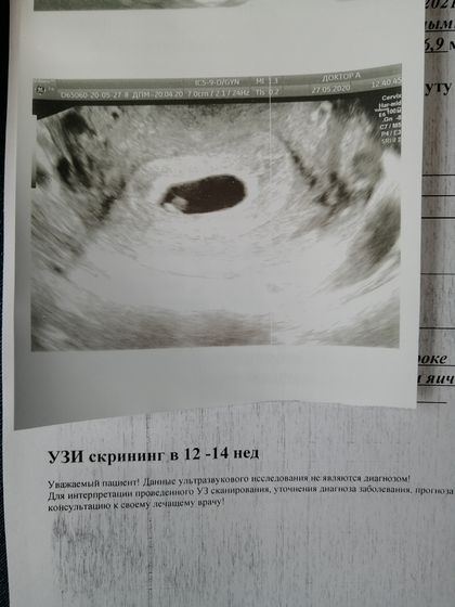 Наше первое УЗИ ???❤️