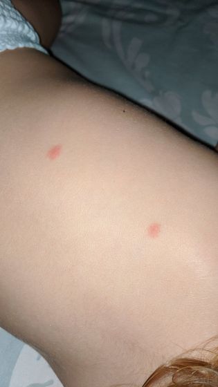 Комары?