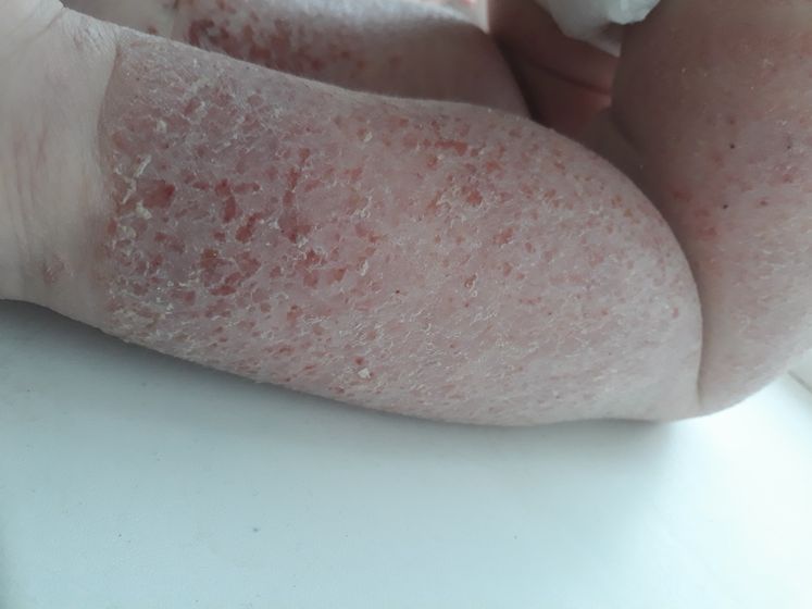 Я разрыдалась у врача. Новости двойни