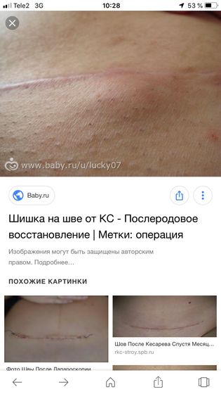 Девочки у кого кс .Фото из интернета .