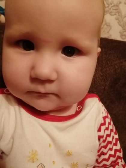Саданулись, об край шкафа???