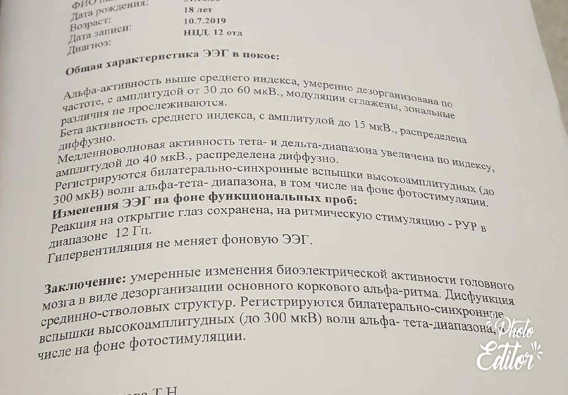 Расшифровка ЭЭГ