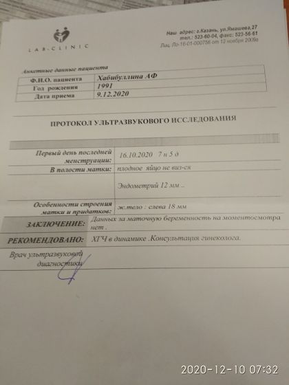 Узи же у меня