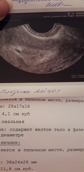 УЗИ на маленьком сроке