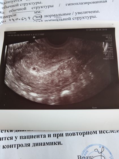 ПЯ не соответствует сроку
