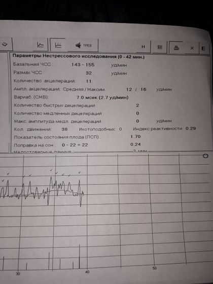 Баллы КТГ