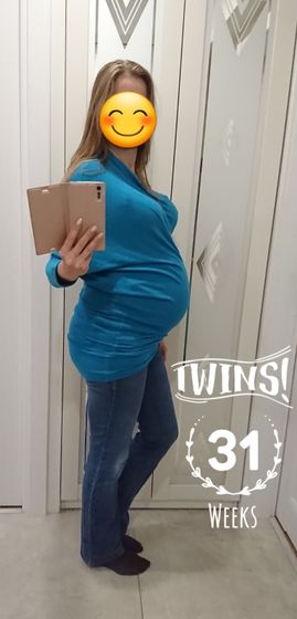 31 неделя_двойня