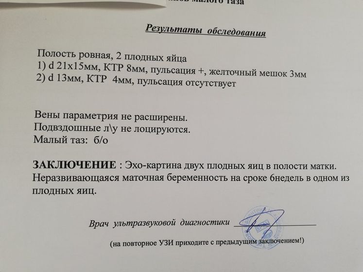 Узи сделали...