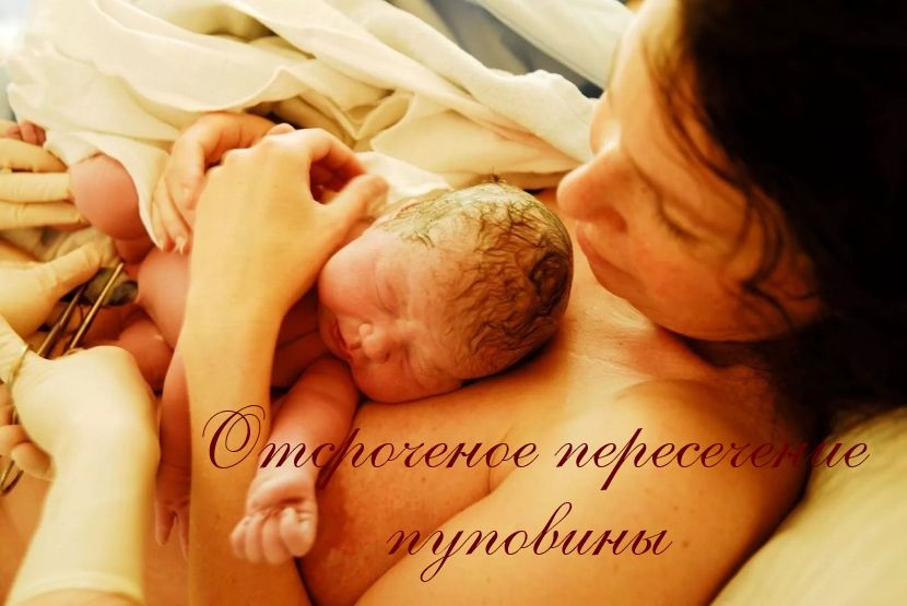 Отсроченное пересечение пуповины