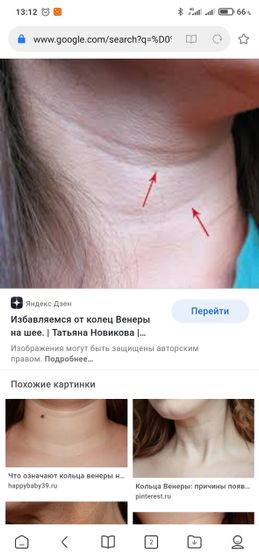 Кольца Венеры