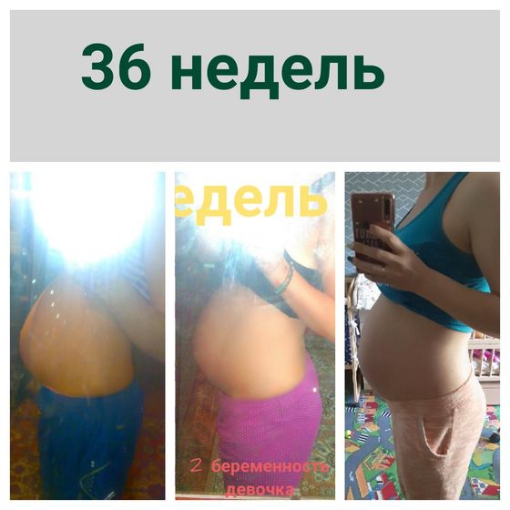 36 недель 3 беременности (сравнение)