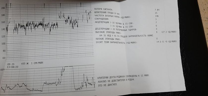 Срок 35 недель 2