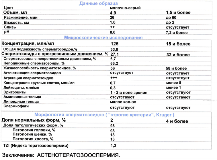 Астенотератозооспермия.