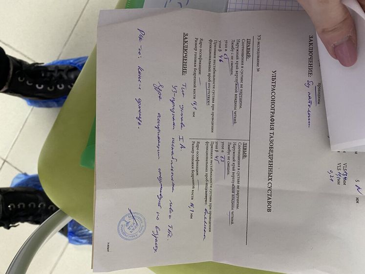 Нестабильность тазобедренного сустава.