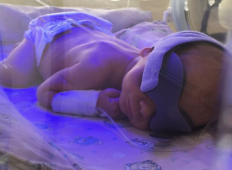 Выносить и родить после диагноза «внематочная»/ разрыв матки