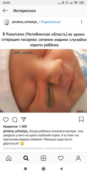 Я думала кесарево безопасно.