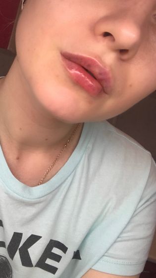 Результат??