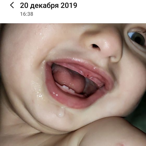 Тумбочкой повредили десна В
