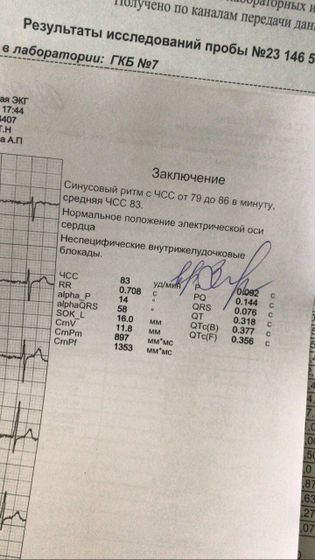 Кто разбирается в экг?