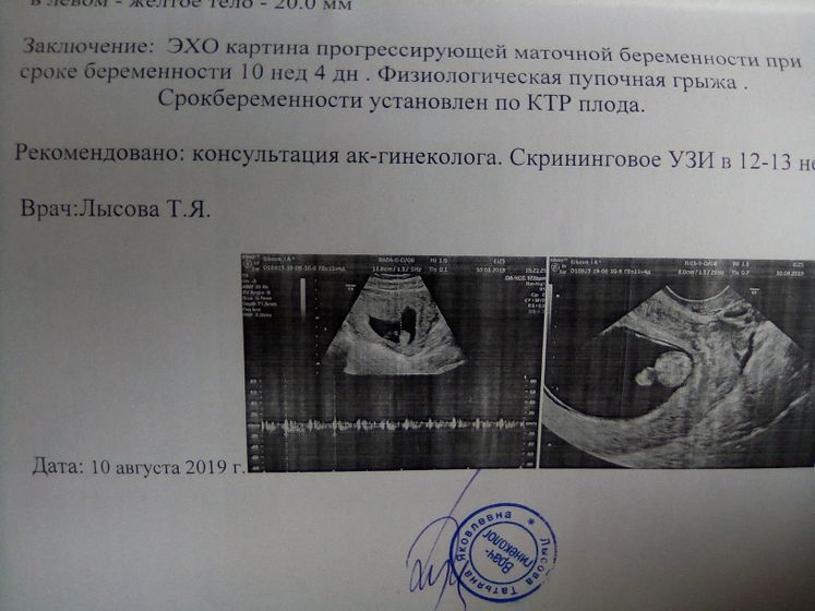 Кто с таким сталкивался?
