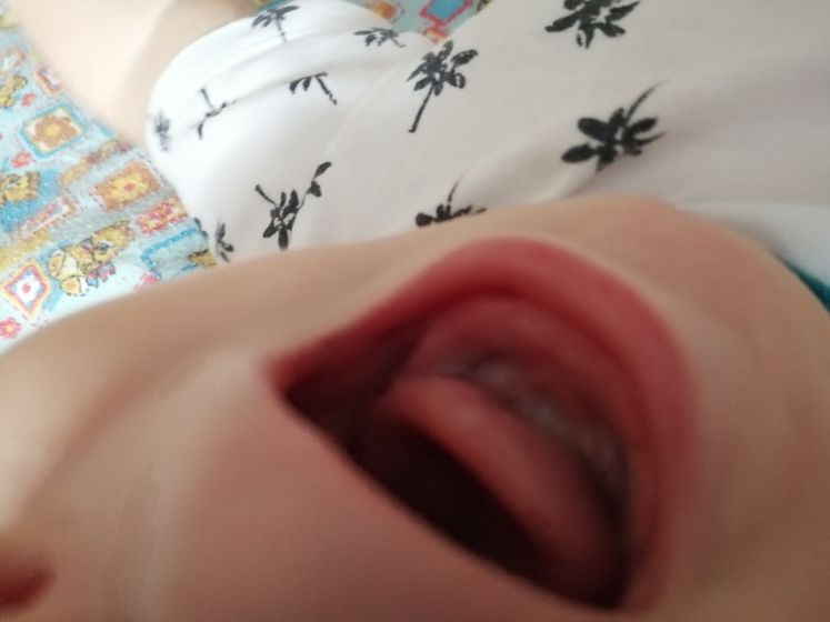 Зубы?