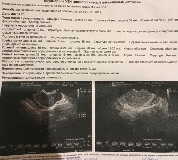 Кто разбирается в узи