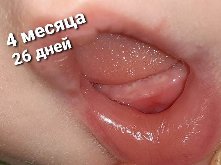 Зубыыыыыы!!!