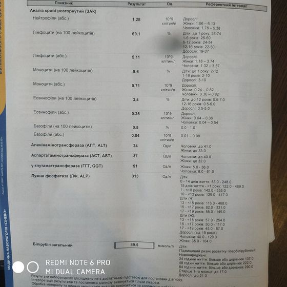 Высокий билирубин в 2.5 мес.