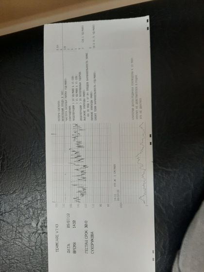 Ктг плода срок 31неделя,