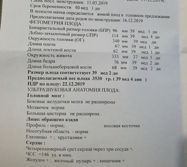 Узи в 39+2,маловодие. Завтра ложусь в предродовое=((