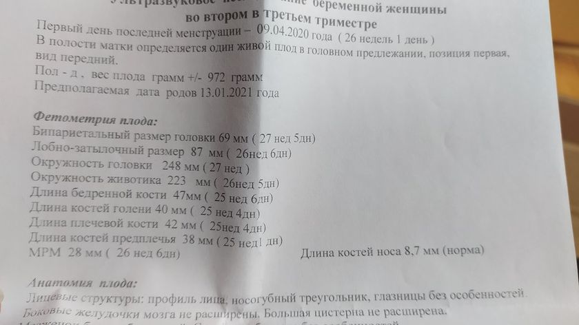 Узи!