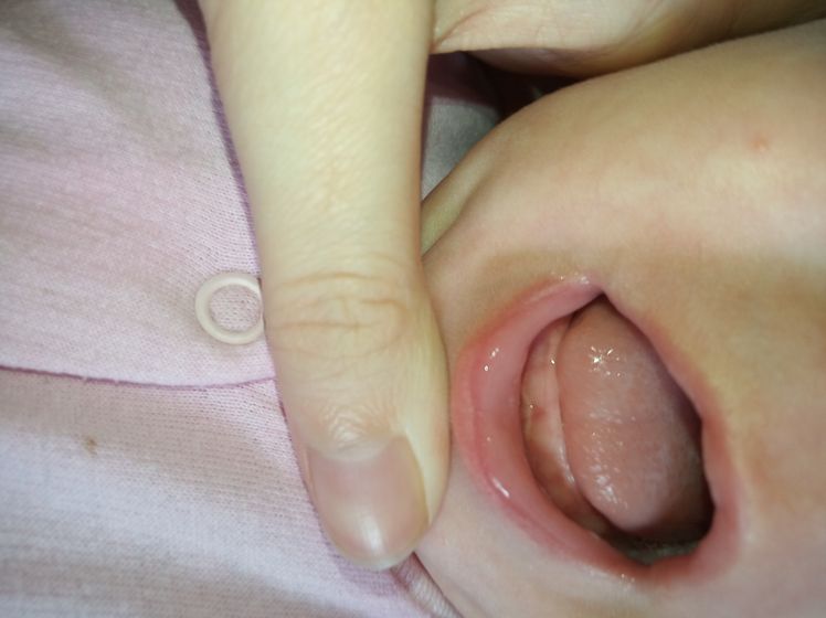 ?